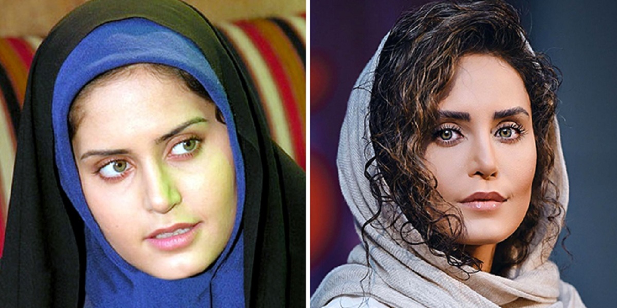 عکس قبل و بعد از عمل الناز شاکردوست